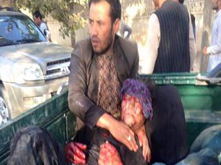  Afganistan'da Kerbela Törenine Saldırı: 50 Şehit 