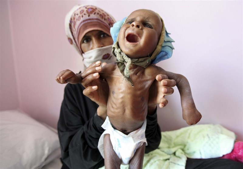 Yemen'de Her 10 Dakikada Bir Çocuk Açlıktan Ölüyor!