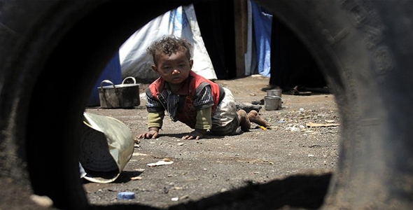 Yemen'de 7 milyon kişi Açlık Tehlikesiyle Karşı Karşıya