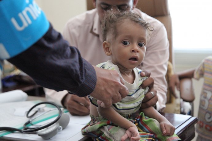 Yemen'de 2.2 Milyon Çocuk Akut Yetersiz Beslenme Sorunu Yaşıyor