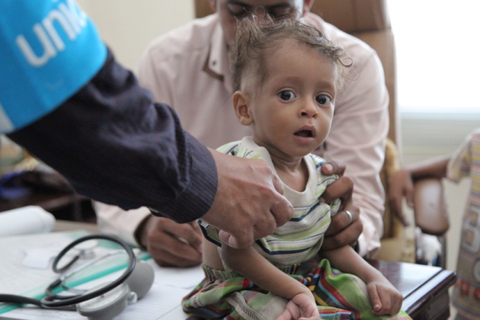 BM: Yemen'de Hastanelere Getirilen 50 Çocuktan 30'u Ölüme Gönderiliyor