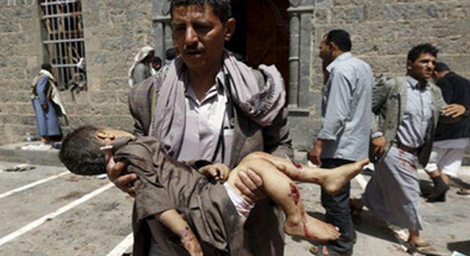 Yemen'de Çok Ağır Bilanço; Bu Yavruların Günahı Neydi'