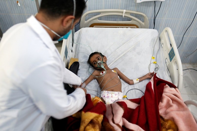 BM: Yemen'i Tamamen Saran Büyük Bir Kıtlık Tehlikesi Var